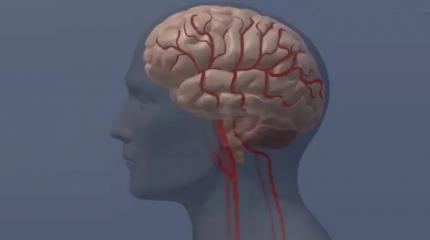 Ученые выяснили, как последствия психоза распространяются по мозгу