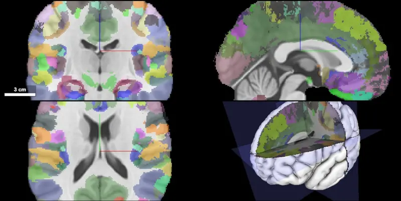 atlases.ebrains.eu